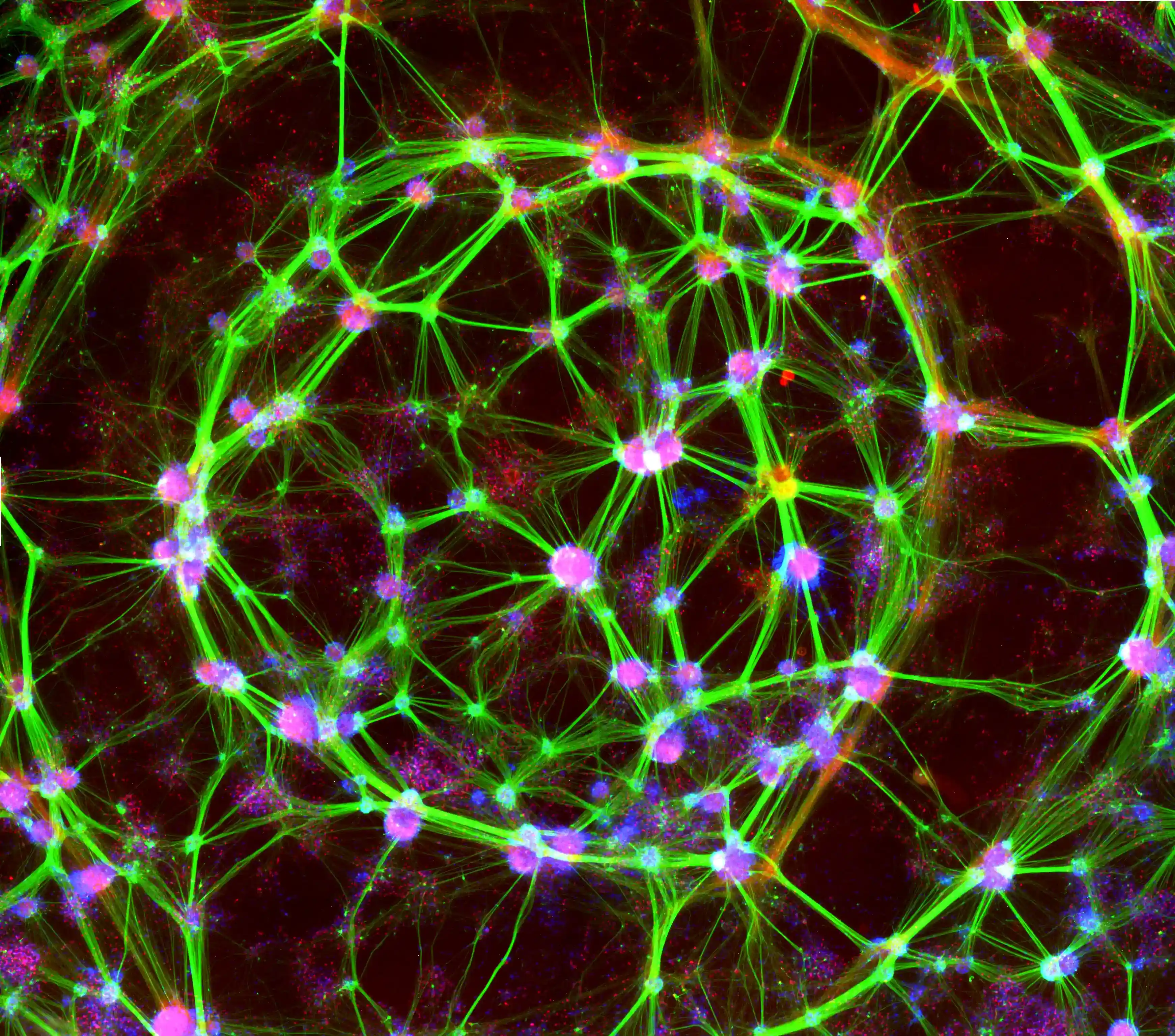 Microphotograph of iPSC-derived dopamine neurons