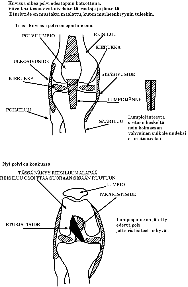 Tietoisku eturistisiteestä